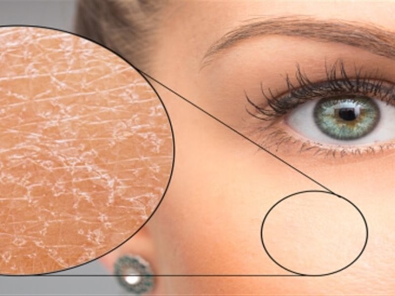 تعانين من جفاف البشرة رغم العناية بها؟.. إليكِ الأسباب