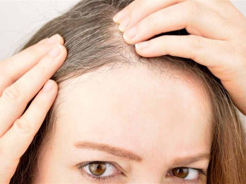 7 مشكلات صحية يخبرك بها شعرك..هل تعاني من أحدهم؟