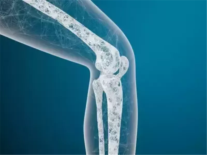 في اليوم العالمي لهشاشة العظام.. إليك أبرز أسبابه وأهم أعراضه 