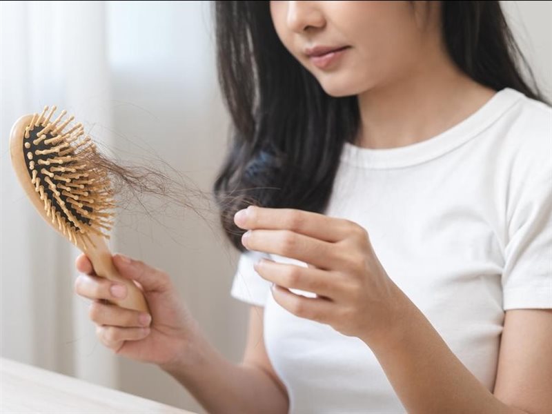5 أسباب مختلفة لتساقط الشعر.. منها التعرض لصدمة عاطفية