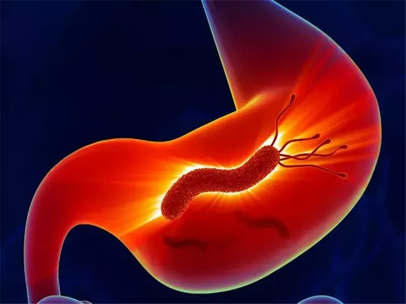 جرثومة المعدة.. هل توجد علامات وأعراض تشير للإصابة بها؟