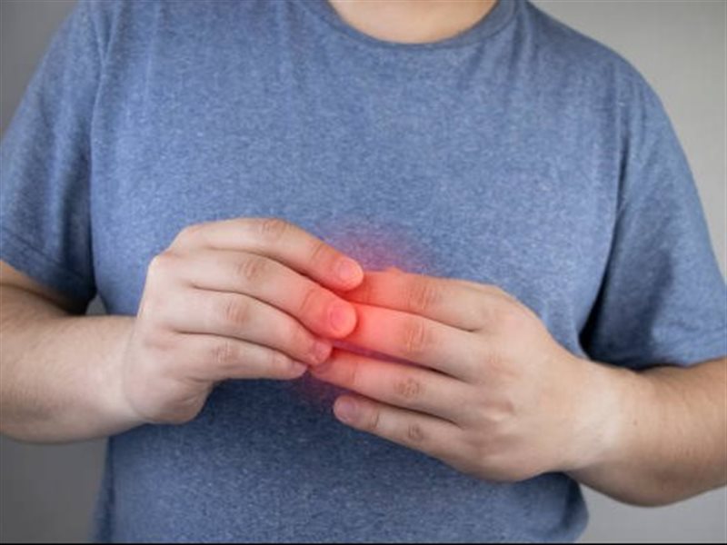 علامات غير عادية لارتفاع نسبة الكوليسترول تظهر في اليدين 