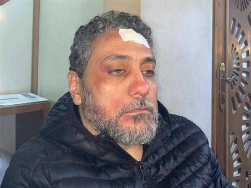 تفاصيل إصابة الفنان تامر فرج في التصوير 