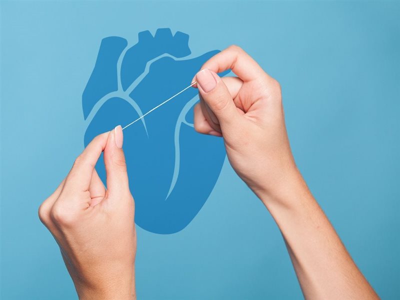 استخدام خيط تنظيف الأسنان مرة في الأسبوع قد يقلل من خطر السكتات الدماغية