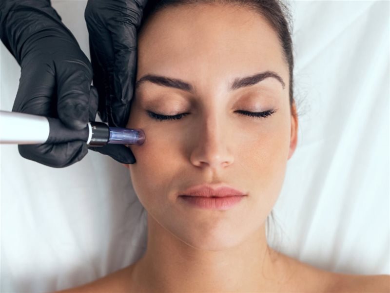 الدكتورة سمر درويش تشير إلى فوائد الديرما بن للبشرة وشروط الحصول على أفضل نتائج