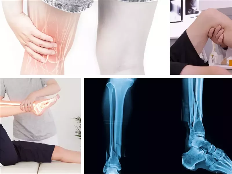 7 علامات تحذيرية لمشاكل صحية يمكن رؤيتها في الساقين 