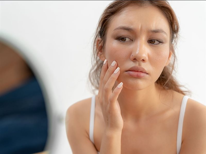 من حب الشباب إلى تساقط الشعر.. هكذا يؤثر تكيس المبايض على شكلك 