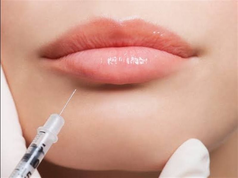 الفلاش فيلرز يتصدّر صيحات الجمال الصيفي 2025: حقن قصيرة الأمد لإشراقة سريعة وطبيعية 