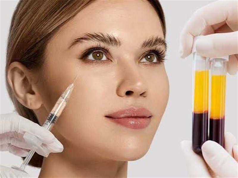  الفيلر الحيوي Bio-Filler: علاج تجميلي آمن يستمد فعاليته من جسمك