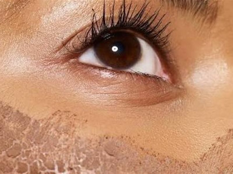 “تقشير الفينول”.. العلاج التجميلي الأخطر في عالم الجلدية: هل يستحق المجازفة؟