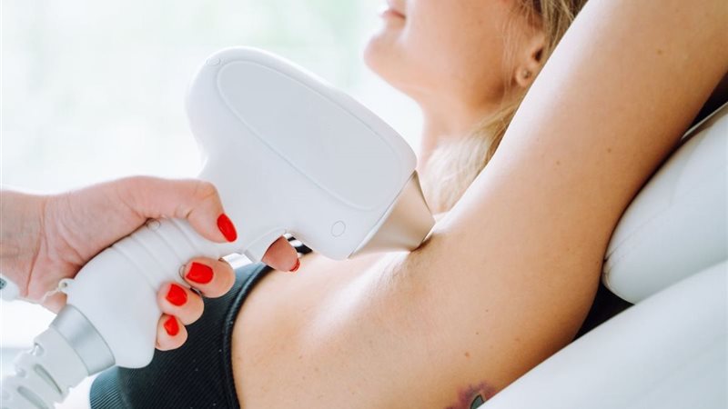 حروق الليزر