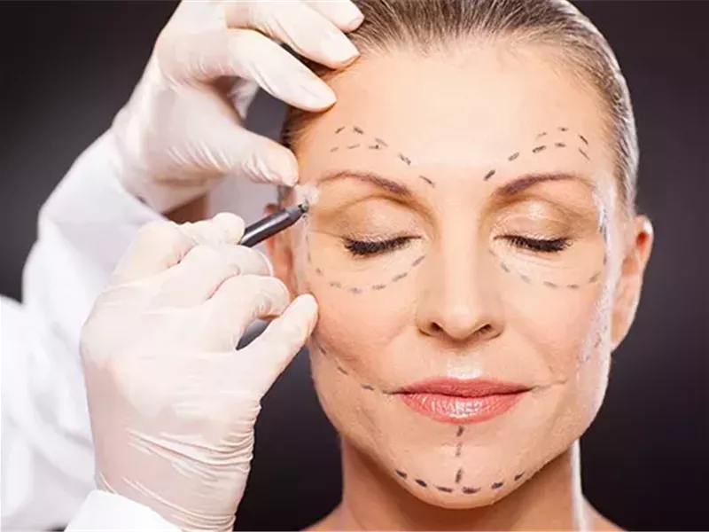 كيف يمكن أن يكون البوتوكس مفيدًا لجوانب أخرى من جسمك؟