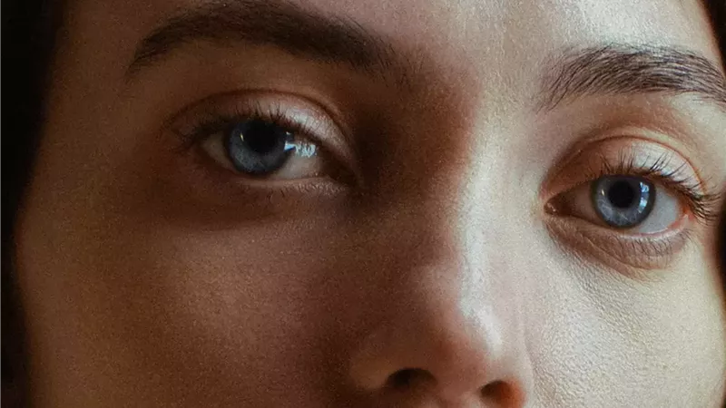 تجاعيد تحت العينين