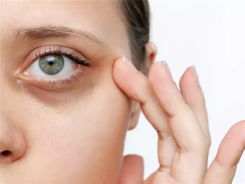  نصائح احترافية لتفتيح منطقة العين ورفعها